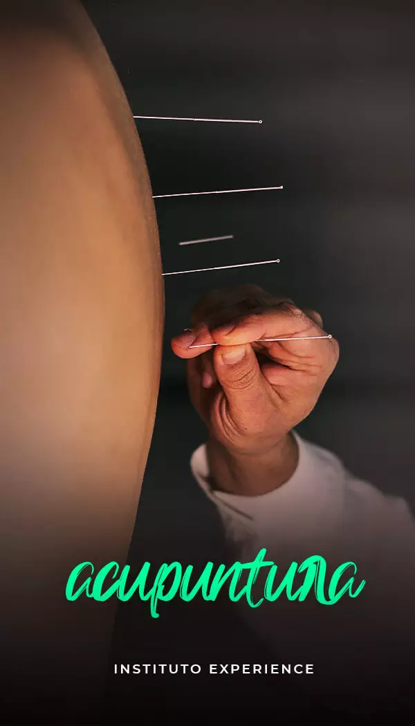 acupuntura